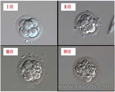 蝶山区医院怎么借卵子_试管婴儿胚胎细胞级别 每级详细讲解