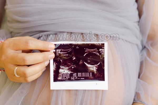 助孕试管婴儿生殖中心_助孕供卵多少_大兴姐妹生二胎做泰国试管婴儿成功率高