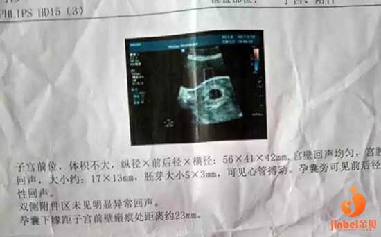 助孕怎么怀孕_在助孕需要多少钱_【天津哪个医院可做供卵试管婴儿】今天是产