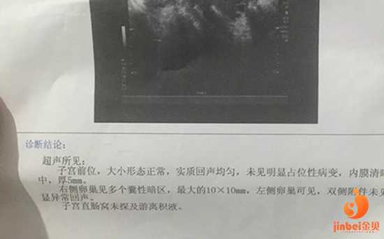 助孕中介哪里提成_助孕中心包生女孩_【广州哪家医院可以做供卵试管婴儿】医